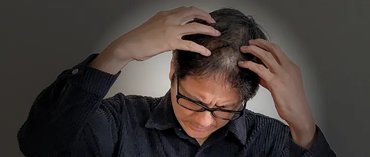 AGA治療を放置するリスク